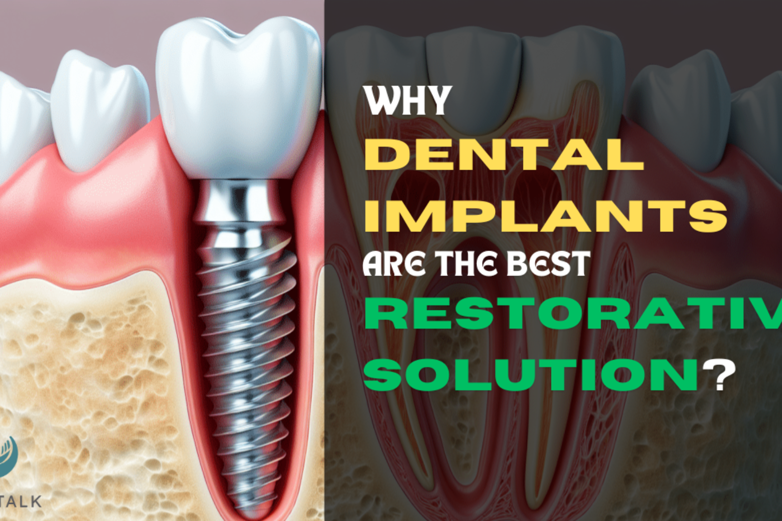 why dental implants are the best restorative solution for the elderly