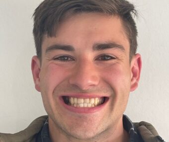 370CA50D-BE4E-42AB-B528-A9AFAA6FFD13 Before - Tooth Talk