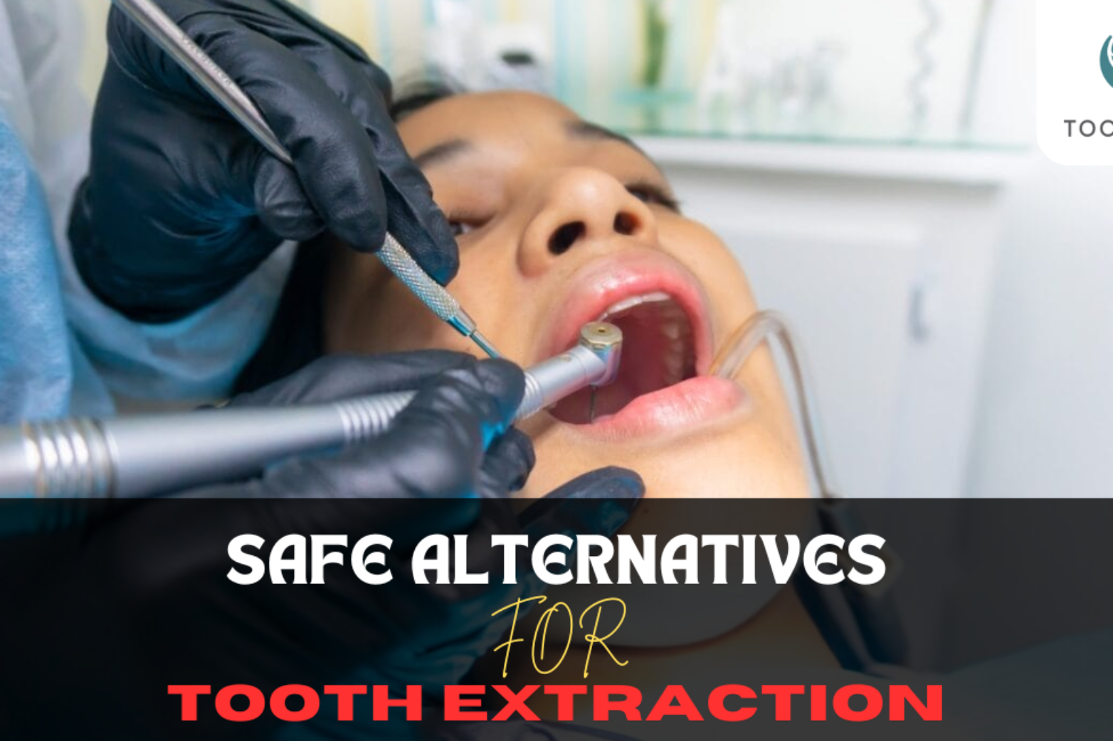 safe alternatives for tooth extraction at home