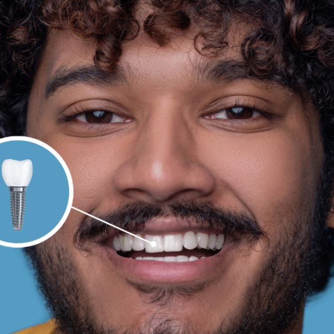 Same-Day Crowns - Are They Really as Durable as Traditional Ones