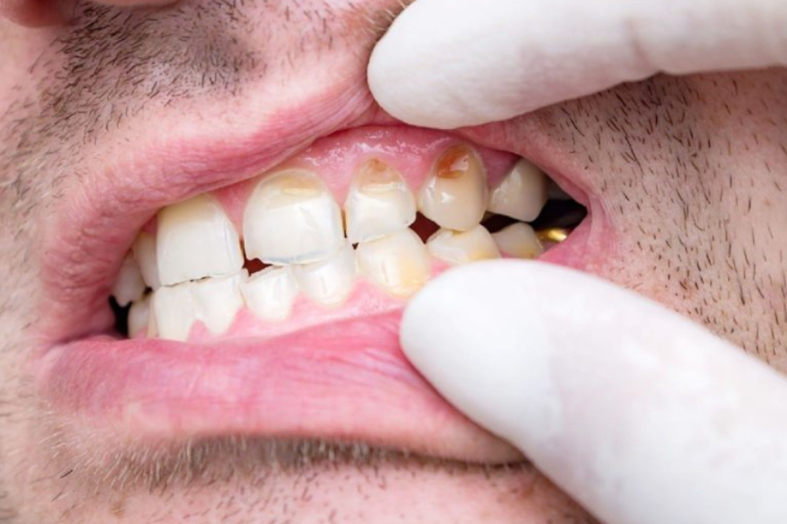 Can Dental Issues Fix Themselves Over Time
