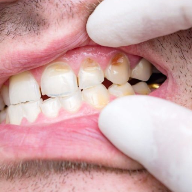 Can Dental Issues Fix Themselves Over Time